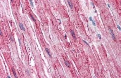 Immunohistochemistry-Paraffin: ADAMTS4 Antibody [NBP3-14532] - ADAMTS4 antibody IHC of human heart. Immunohistochemistry of formalin-fixed, paraffin-embedded tissue after heat-induced antigen retrieval.